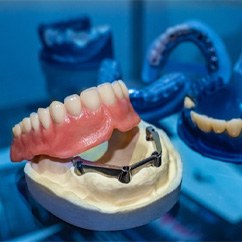 implant dentures in Fayetteville